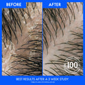 Head & Shoulders 2 in 1 Dandruff Shampoo and Conditioner, Classic Clean, 12.5 fl oz